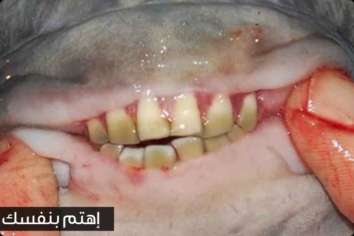 سمكة الباكو الأسطورية التي تملك أسنانا مثل أسنان البشر
