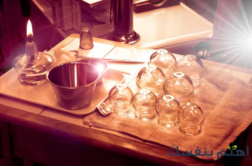 المعدات اللازمة لجسلة علاج بكاسات الهواء