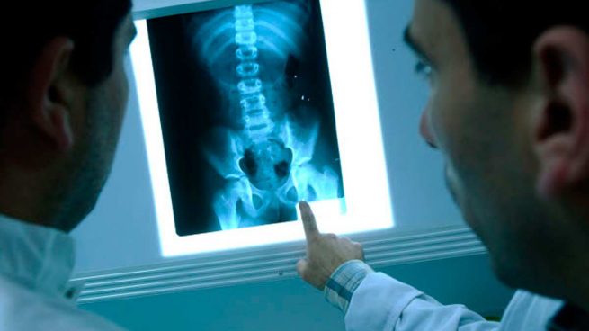 تاريخ اكتشاف الأشعة السينية : صدفة أحدثت ثورة طبية - إهتم بنفسك |  ihtambnafsak.com